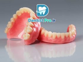 معایب دندان مصنوعی چیست؟