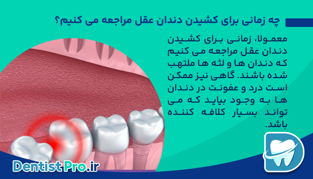 دردِ کشیدن دندان عقل چقدر طول می کشد؟