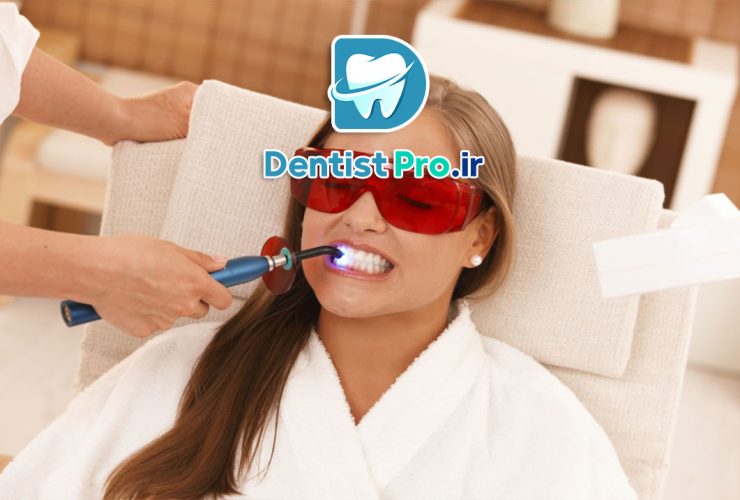  تاثیرات و احتیاطات بلیچینگ در شیردهی