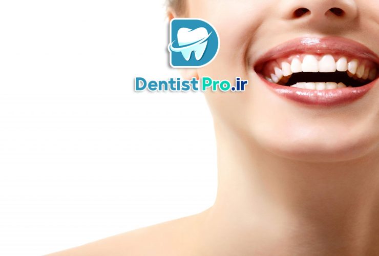 بلیچینگ دندان، روشی ساده و کم هزینه برای سفید کردن دندان ها