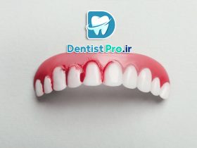 چرا برخی از دندان ‌ها بیشتر مستعد پوسیدگی هستند؟