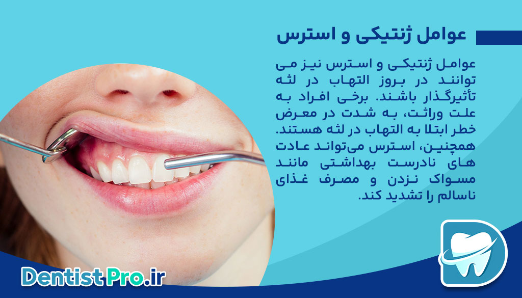 بررسی دلایل التهاب لثه ها