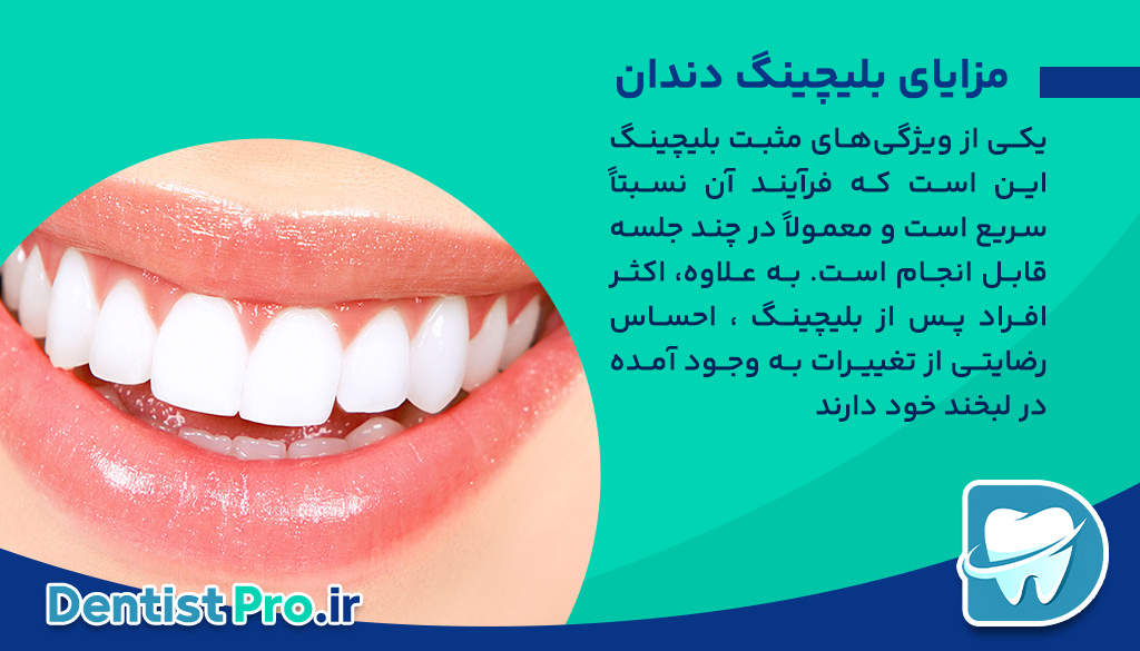 بلیچینگ دندان، روشی ساده و کم هزینه برای سفید کردن دندان ها