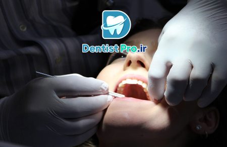 چه موقع جراحی دندان نهفته نیاز است؟