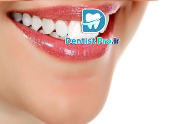 چگونه دندان های صاف و یکدست داشته باشیم؟