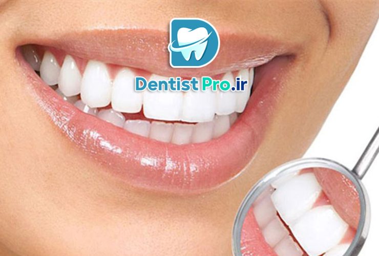 لمینت دندان در افراد سیگاری، چالش‌ها و نکات مهم