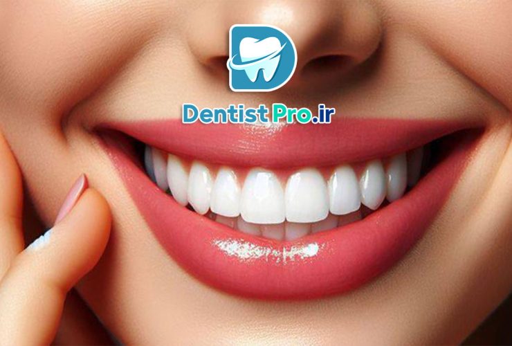 آشنایی با رنگ های محبوب لمینت دندان