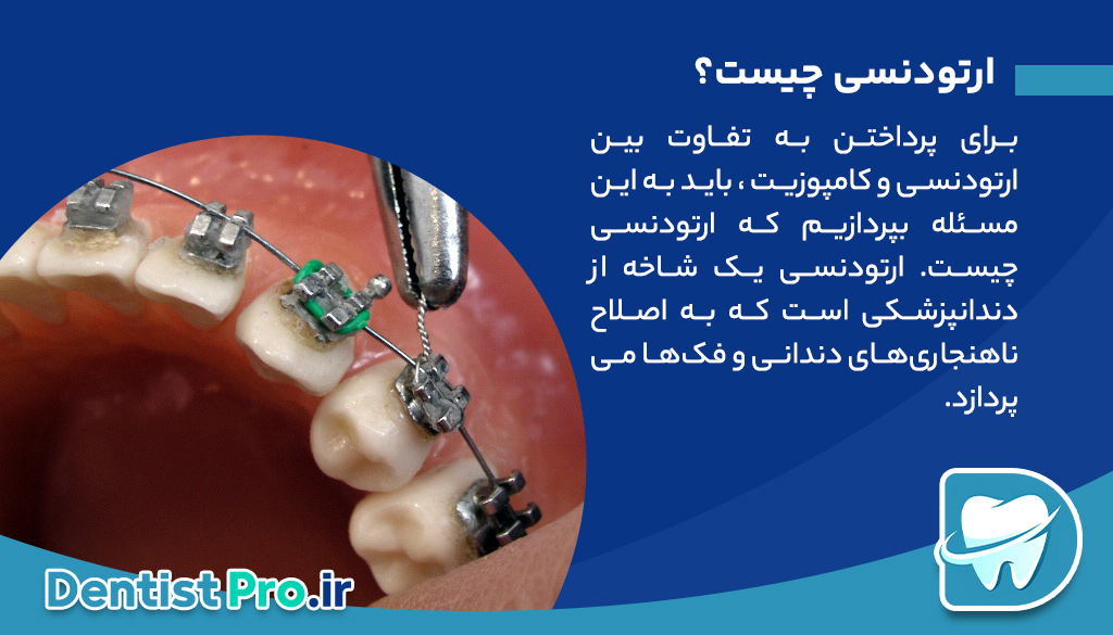 تفاوت بین ارتودنسی و کامپوزیت، کدام روش برای شما مناسبتر است؟ 26 تفاوت بین ارتودنسی و کامپوزیت، کدام روش برای شما مناسبتر است؟