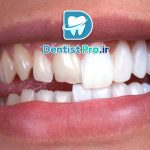 دندانپزشکی برای اصلاح طرح لبخند+ 10 راهکار موثر