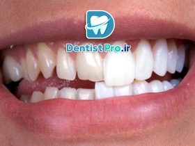 دندانپزشکی برای اصلاح طرح لبخند+ 10 راهکار موثر
