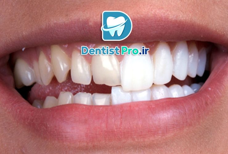 دندانپزشکی برای اصلاح طرح لبخند+ 10 راهکار موثر