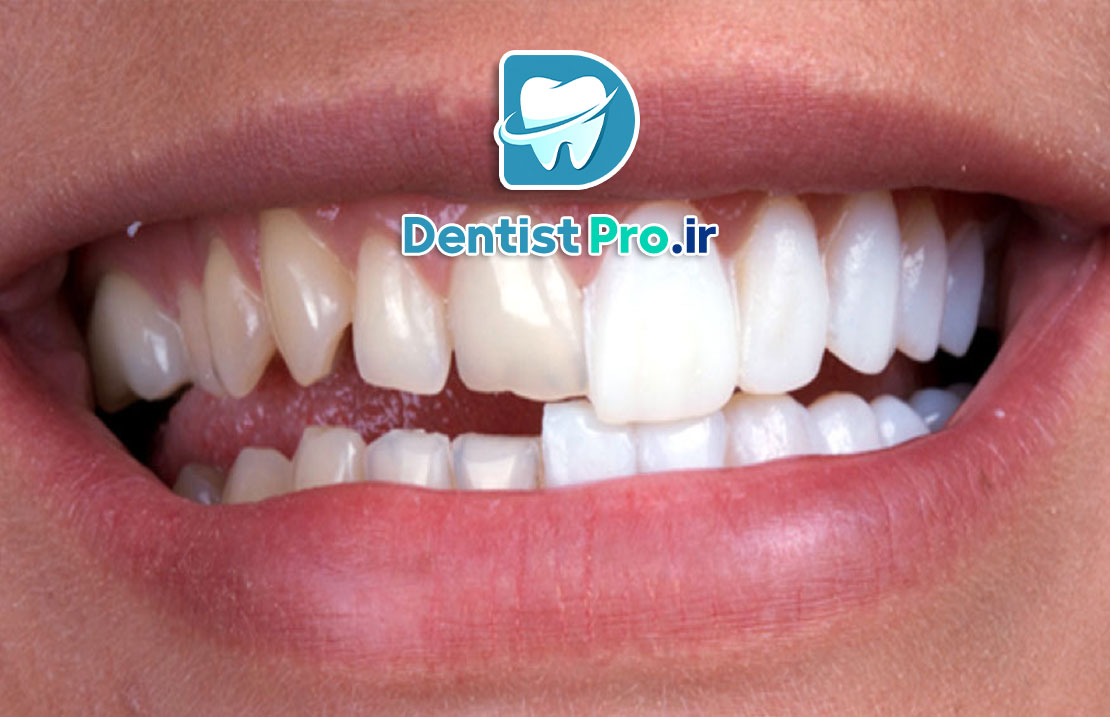 دندانپزشکی برای اصلاح طرح لبخند+ 10 راهکار موثر