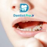 جراحی لثه به روش های نوین؛ تحول در سلامت و زیبایی دهان