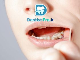 جراحی لثه به روش های نوین؛ تحول در سلامت و زیبایی دهان