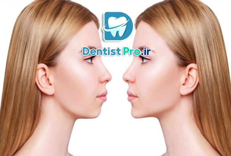 جراحی زیبایی فک؛ تعادل چهره، اعتماد به‌نفس دوباره