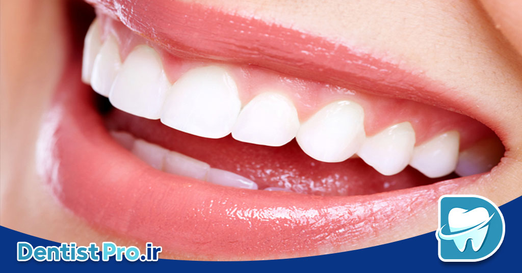 دندان های بدون نقص؛ لبخند کامل، زندگی کاملتر 27 دندان های بدون نقص؛ لبخند کامل، زندگی کاملتر