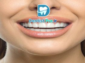 دندان های بدون نقص؛ لبخند کامل، زندگی کامل‌تر