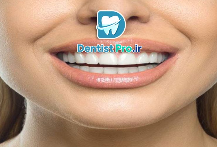 دندان های بدون نقص؛ لبخند کامل، زندگی کامل‌تر