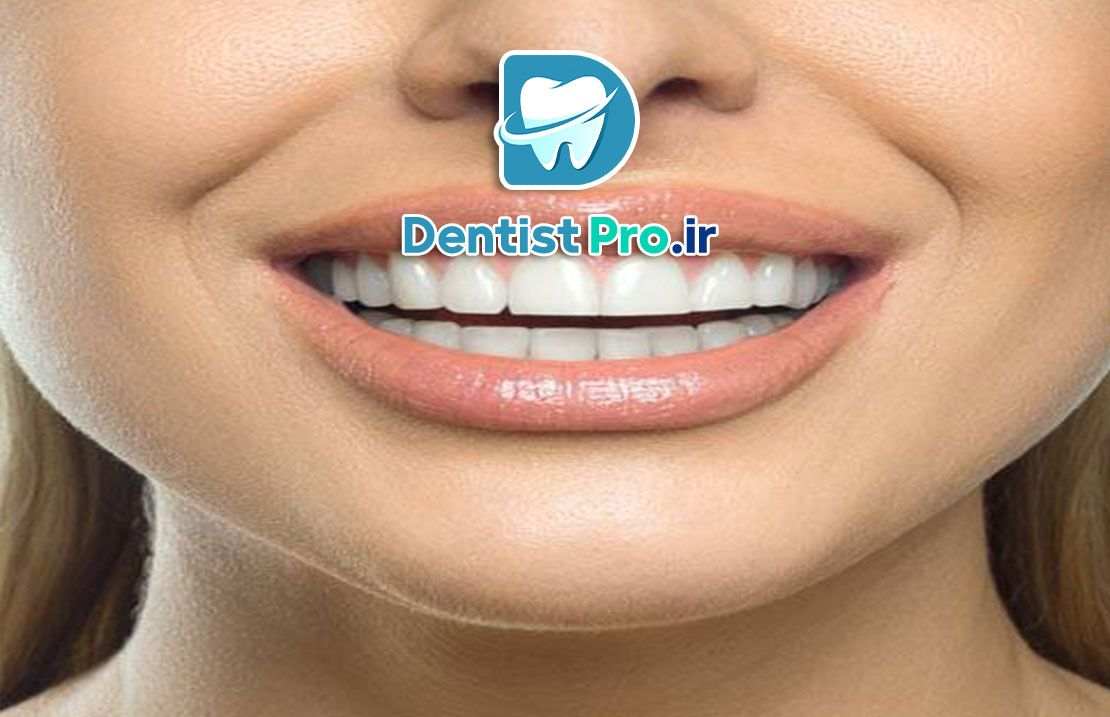 دندان های بدون نقص؛ لبخند کامل، زندگی کاملتر 25 دندان های بدون نقص؛ لبخند کامل، زندگی کاملتر