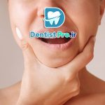 راه حل های سریع برای مشکلات دندانپزشکی+ 15 راهکار موثر