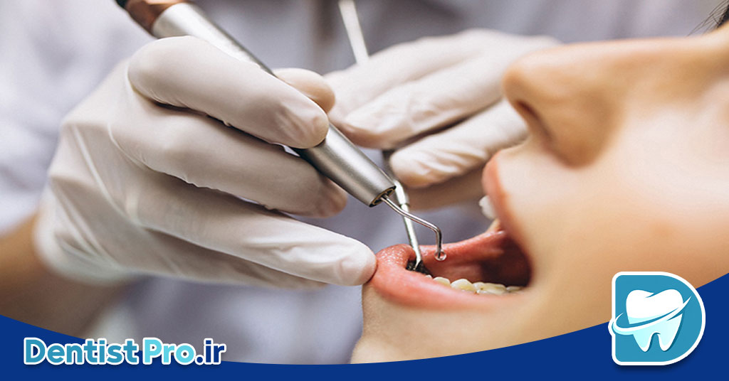 حل مشکلات دندانپزشکی در کمترین زمان؛ نجات لبخند در سریع‌ترین حالت ممکن