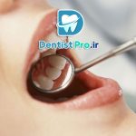 حل مشکلات دندانپزشکی در کمترین زمان؛ نجات لبخند در سریع‌ترین حالت ممکن