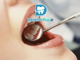 حل مشکلات دندانپزشکی در کمترین زمان؛ نجات لبخند در سریع‌ترین حالت ممکن