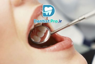 حل مشکلات دندانپزشکی در کمترین زمان؛ نجات لبخند در سریع‌ترین حالت ممکن