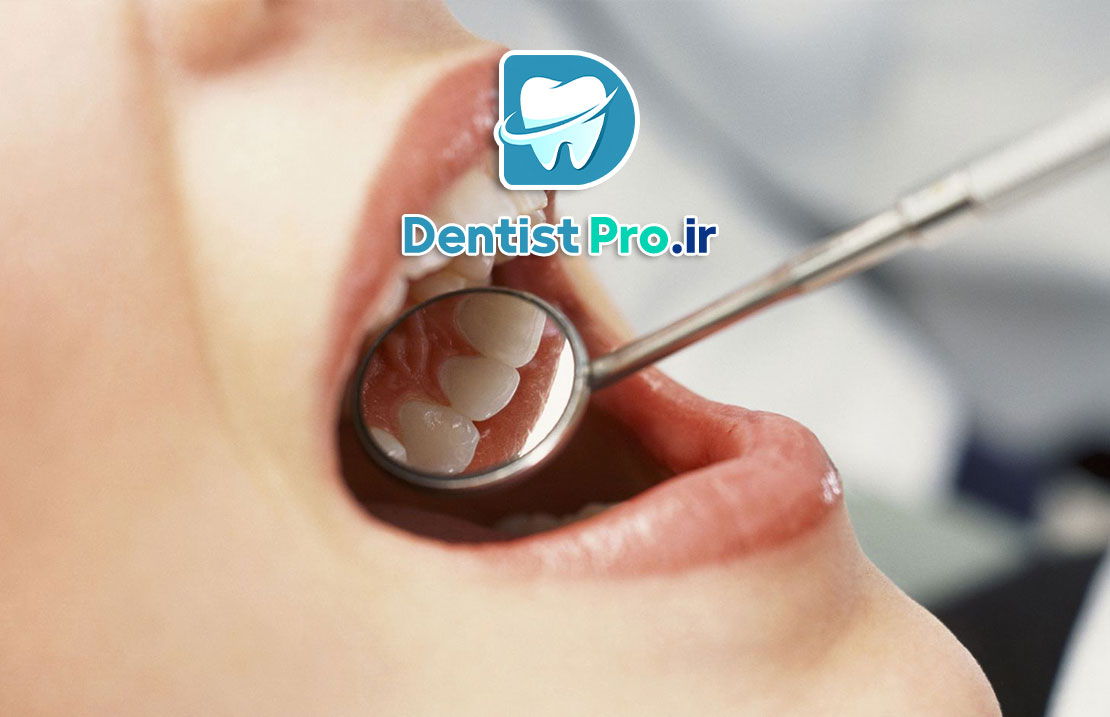 حل مشکلات دندانپزشکی در کمترین زمان؛ نجات لبخند در سریع‌ترین حالت ممکن