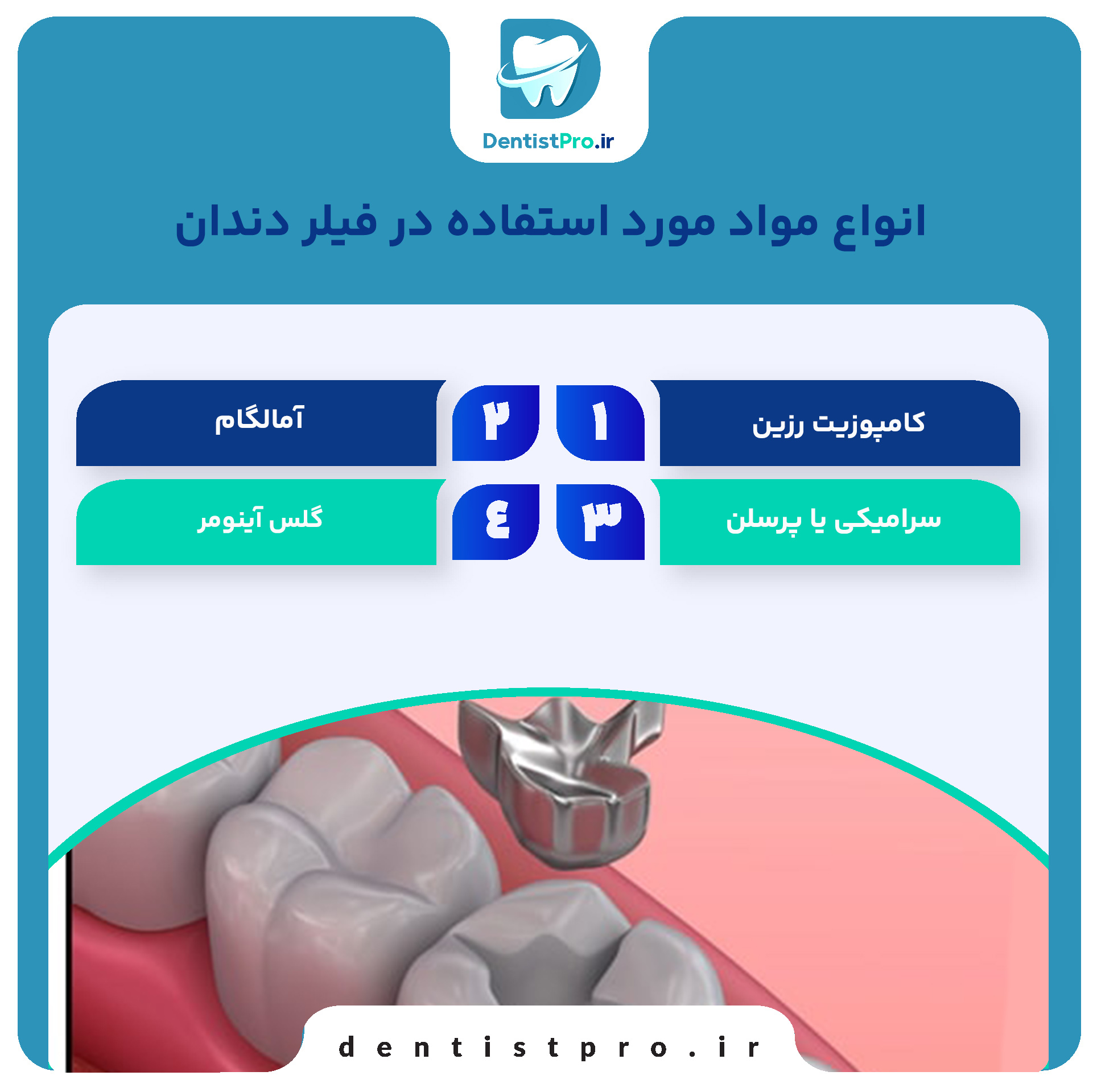 فیلر دندان؛ ترمیمی سریع برای لبخندی زیبا و سالم 29 فیلر دندان؛ ترمیمی سریع برای لبخندی زیبا و سالم