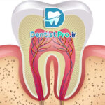 درمان پالپ دندان شیری: راهنمای جامع حفظ سلامت دندان‌های کودکان