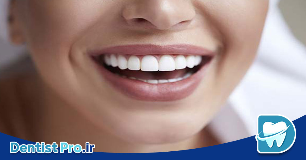 لمینت دندان خراب: علل، عوارض و راه‌های پیشگیری