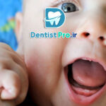 دیر درآمدن دندان کودک؛ بررسی جامع دلایل، علائم و راهکارها