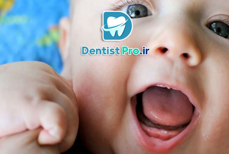 دیر درآمدن دندان کودک؛ بررسی جامع دلایل، علائم و راهکارها
