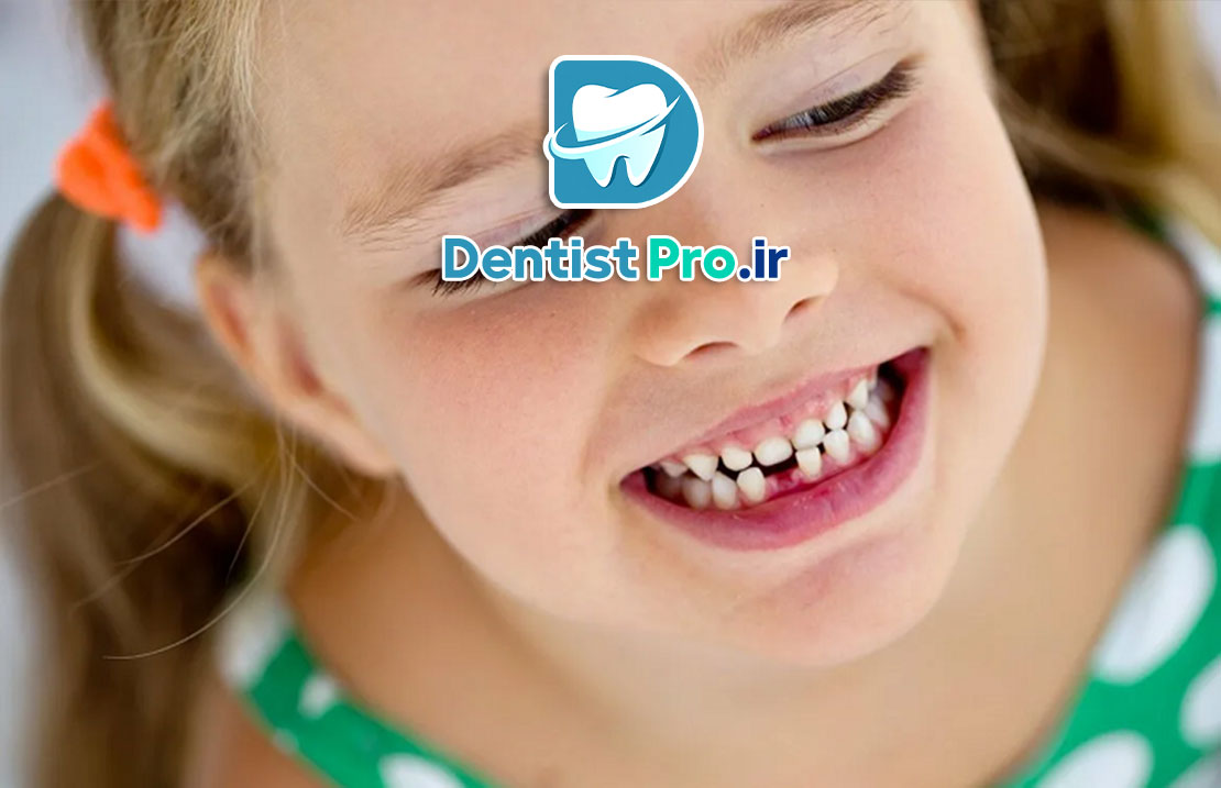 ناهنجاری دندانی در کودکان: علل، انواع، درمان‌ها و راه‌های پیشگیری
