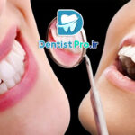 باندینگ دندان: روشی ساده و موثر برای اصلاح ظاهر دندان‌ها