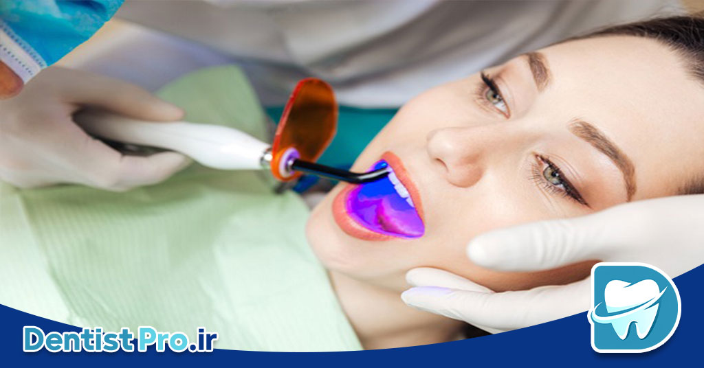 رنگبندی کامپوزیت دندان: راهنمای کامل برای انتخاب رنگ مناسب و تأثیرات آن در زیبایی لبخند