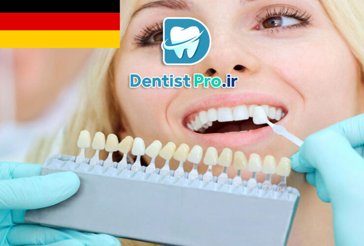 لمینت دندان آلمانی: ترکیبی از تکنولوژی، زیبایی و دوام