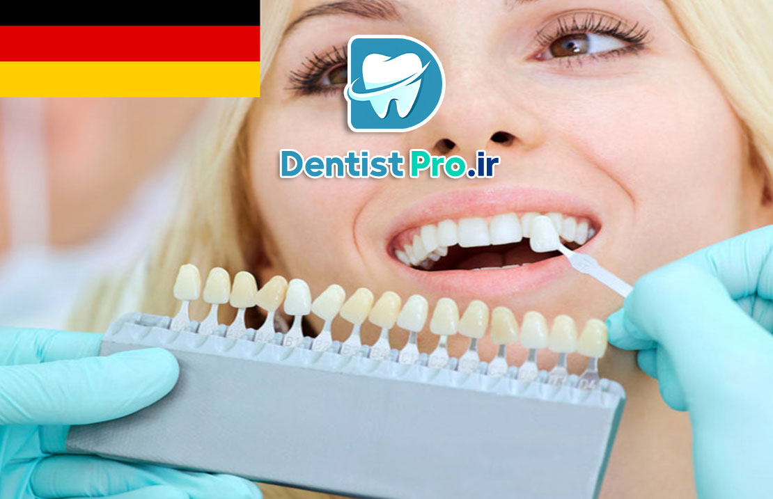 لمینت دندان آلمانی: ترکیبی از تکنولوژی، زیبایی و دوام