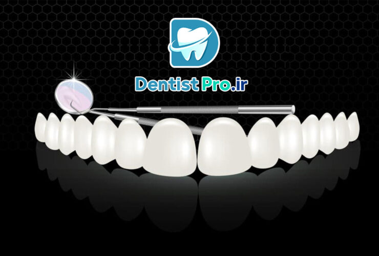 کامپوزیت موقت: راهکاری ضروری در دندان‌پزشکی مدرن