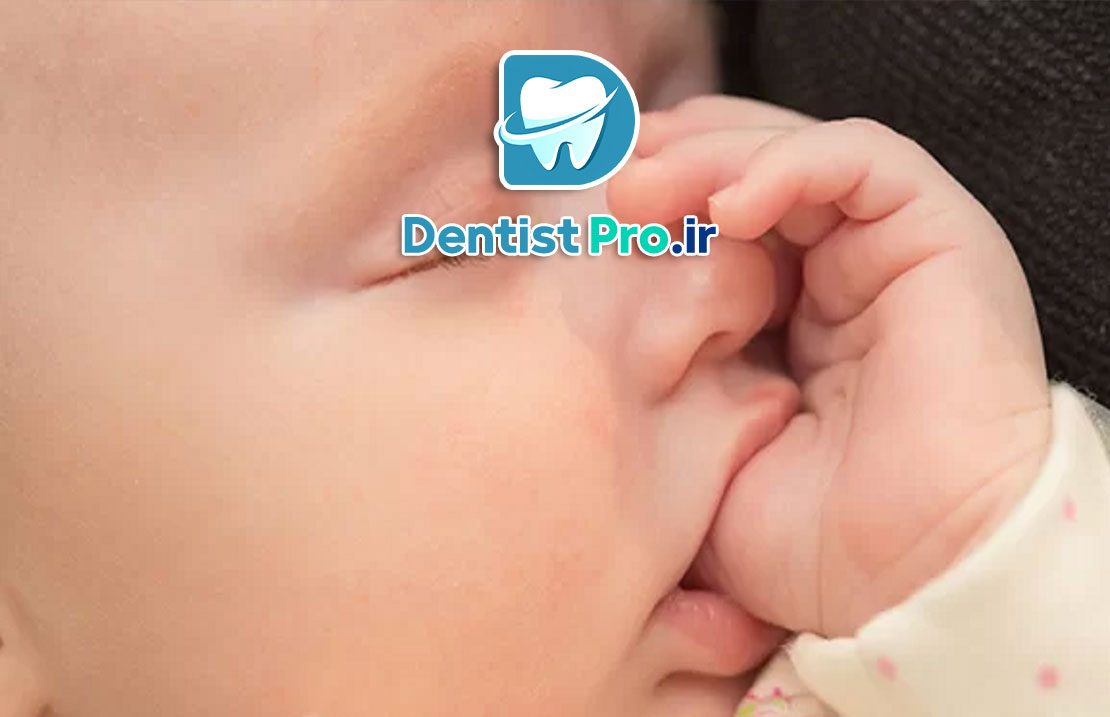 مکیدن انگشت در کودکان: عادت طبیعی یا تهدیدی برای سلامت؟