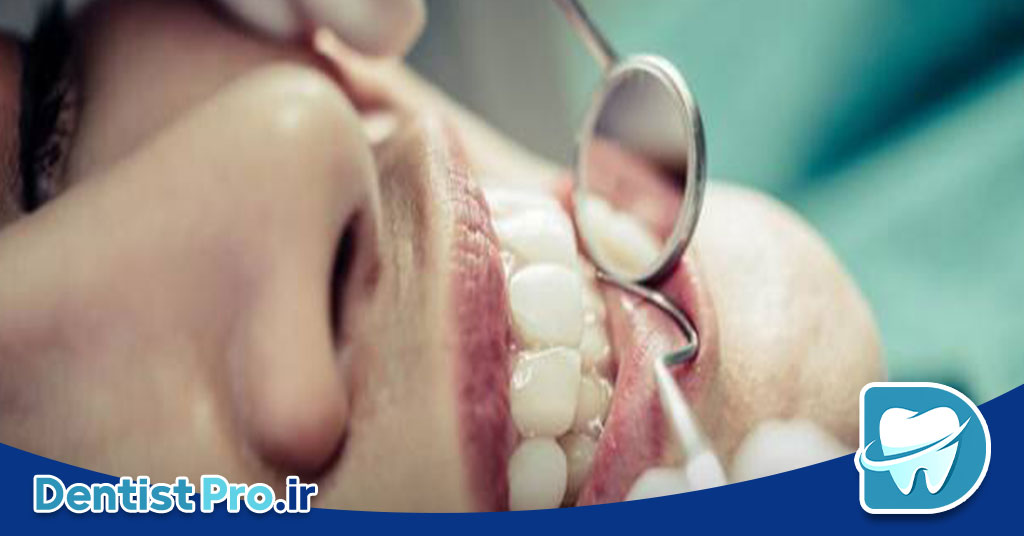 بهترین کلینیک کامپوزیت؛ انتخابی هوشمندانه برای لبخندی بینقص 29 بهترین کلینیک کامپوزیت؛ انتخابی هوشمندانه برای لبخندی بینقص