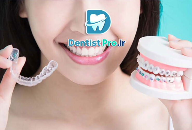 تفاوت ارتودنسی ثابت و متحرک: بررسی کامل روش‌ها، مزایا و معایب
