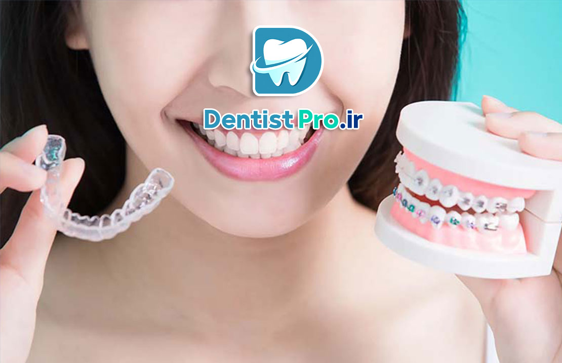 تفاوت ارتودنسی ثابت و متحرک: بررسی کامل روشها، مزایا و معایب 25 تفاوت ارتودنسی ثابت و متحرک: بررسی کامل روشها، مزایا و معایب