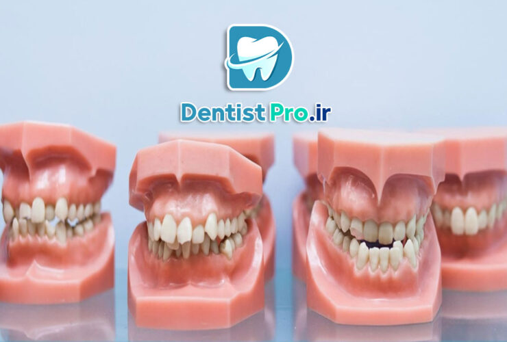 مال اکلوژن: بررسی جامع اختلالات قرارگیری دندان‌ها و راه‌های درمانی