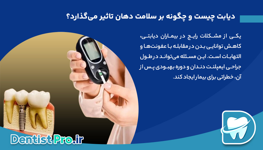 ایمپلنت برای افراد دیابتی: بررسی جامع، نکات مهم و مراقبتها 26 ایمپلنت برای افراد دیابتی: بررسی جامع، نکات مهم و مراقبتها
