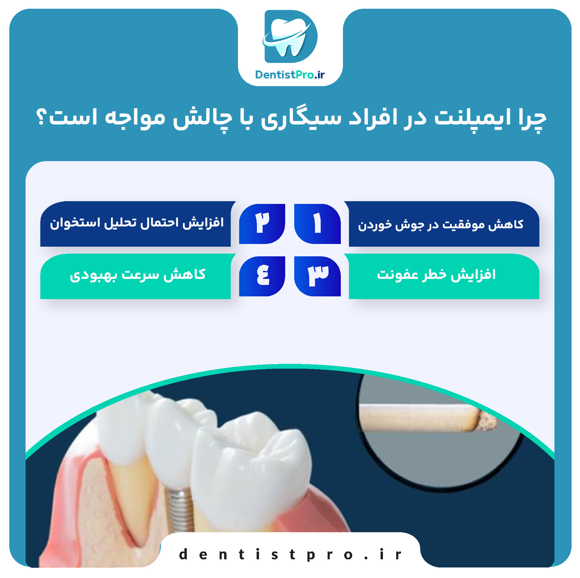 ایمپلنت در افراد سیگاری: چالشها، عوارض و راهکارها 27 ایمپلنت در افراد سیگاری: چالشها، عوارض و راهکارها