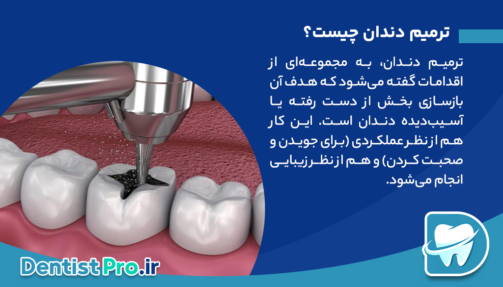 ترمیم دندان ها با مواد درجه یک؛ ترکیبی از دوام، زیبایی و سلامت