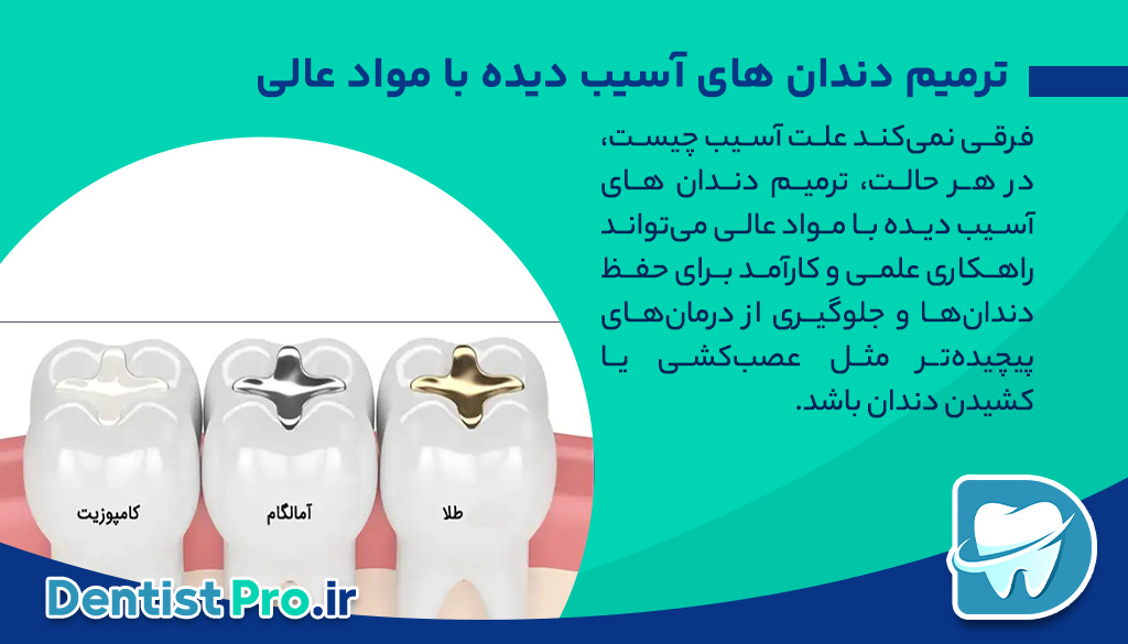 ترمیم دندان های آسیب دیده با مواد عالی؛ بازسازی لبخند با ماندگاری بالا 26 ترمیم دندان های آسیب دیده با مواد عالی؛ بازسازی لبخند با ماندگاری بالا