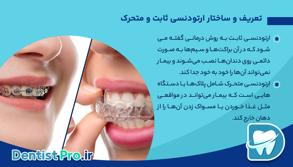 تفاوت ارتودنسی ثابت و متحرک: بررسی کامل روشها، مزایا و معایب 26 تفاوت ارتودنسی ثابت و متحرک: بررسی کامل روشها، مزایا و معایب